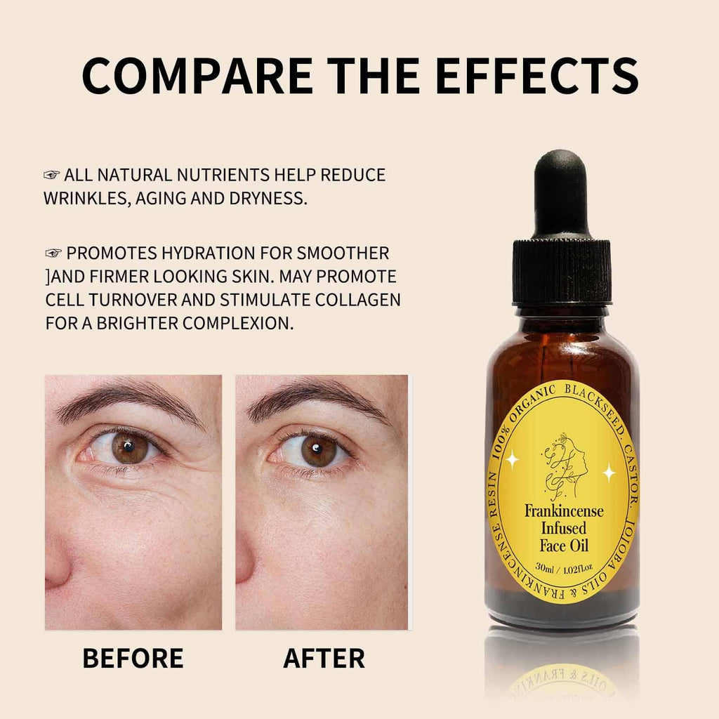 Frankincense Resin Oil Facial Serum 3PC H392426